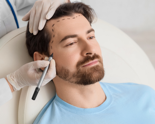 Hair Transplant Consultation